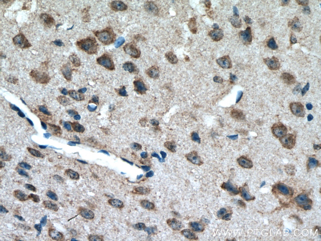 Immunohistochemistry (IHC) staining of mouse brain tissue using MOBP Polyclonal antibody (12472-1-AP)
