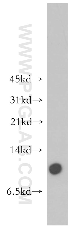 WB analysis of mouse brain using 12472-1-AP