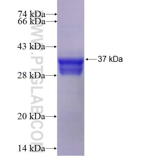 MOBP fusion protein Ag3156 SDS-PAGE