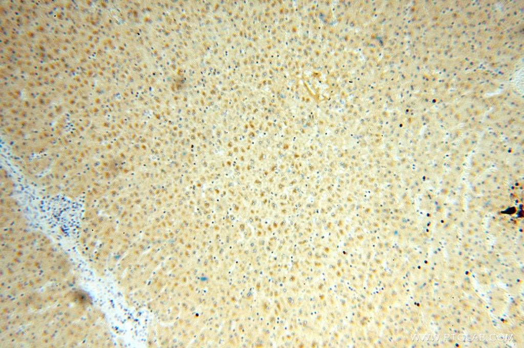 Immunohistochemistry (IHC) staining of human liver tissue using MOCOS Polyclonal antibody (16395-1-AP)