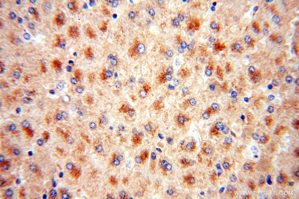 Immunohistochemistry (IHC) staining of human liver tissue using MOCOS Polyclonal antibody (16395-1-AP)