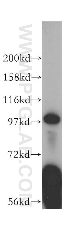 Western Blot (WB) analysis of HepG2 cells using MOCOS Polyclonal antibody (16395-1-AP)