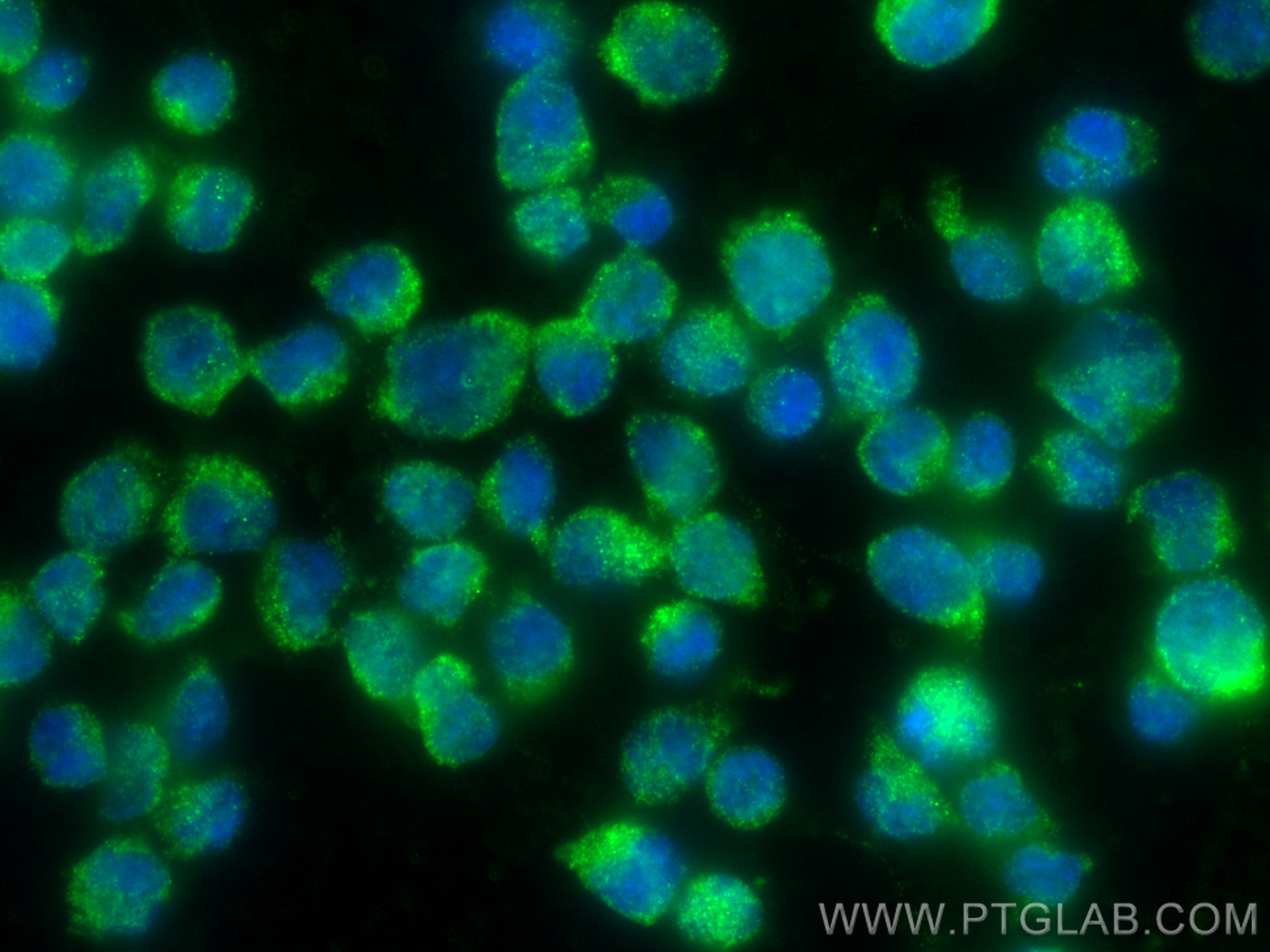 IF Staining of Jurkat using 31550-1-AP (same clone as 31550-1-PBS) Immunofluorescence (IF) / fluorescent staining of Jurkat cells using MOCS1 Polyclonal antibody (31550-1-AP)