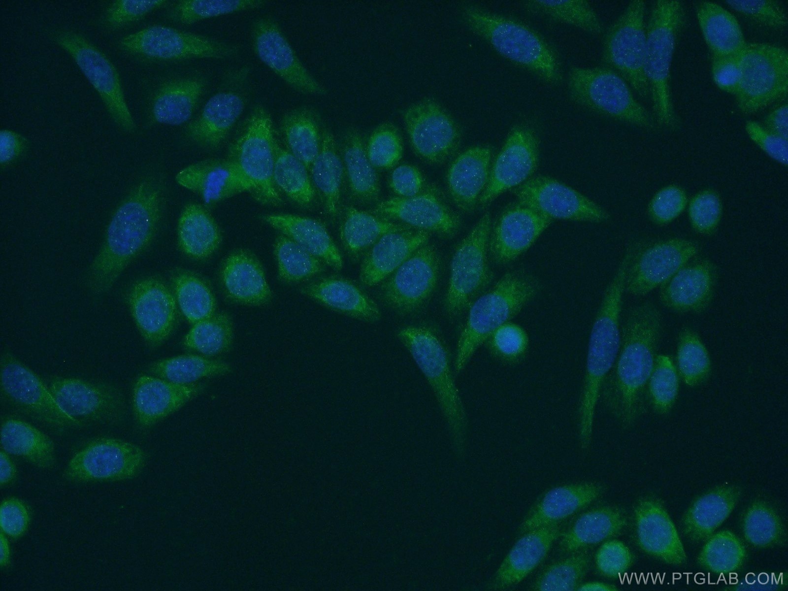 Immunofluorescence (IF) / fluorescent staining of HeLa cells using MOCS2B Polyclonal antibody (14416-1-AP)