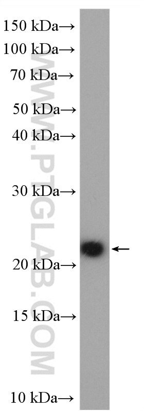Western Blot (WB) analysis of HeLa cells using MOCS2B Polyclonal antibody (14416-1-AP)