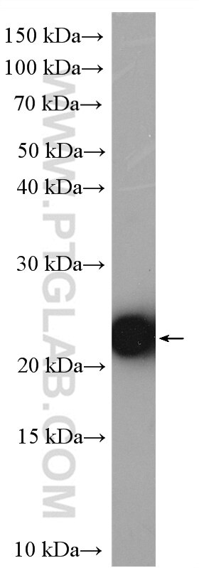 Western Blot (WB) analysis of Jurkat cells using MOCS2B Polyclonal antibody (14416-1-AP)