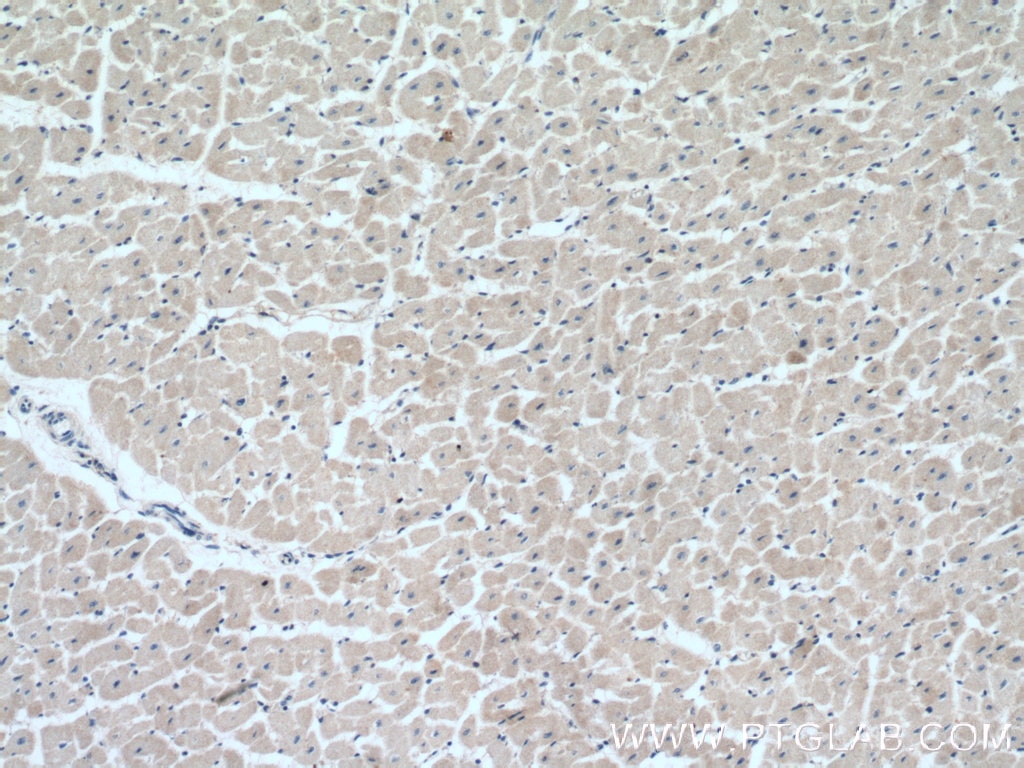 Immunohistochemistry (IHC) staining of human heart tissue using MOCS3 Polyclonal antibody (27501-1-AP)