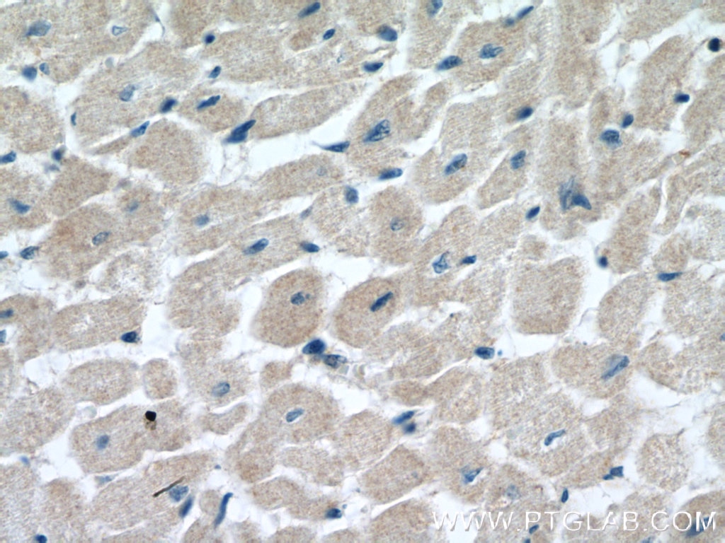 Immunohistochemistry (IHC) staining of human heart tissue using MOCS3 Polyclonal antibody (27501-1-AP)