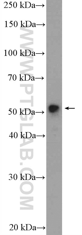 WB analysis of MCF-7 using 13842-1-AP