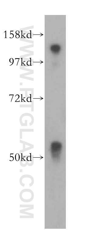 Western Blot (WB) analysis of HeLa cells using MOF Polyclonal antibody (13842-1-AP)
