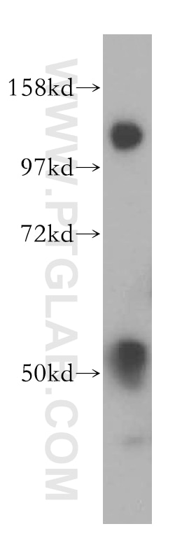 Western Blot (WB) analysis of MCF-7 cells using MOF Polyclonal antibody (13842-1-AP)