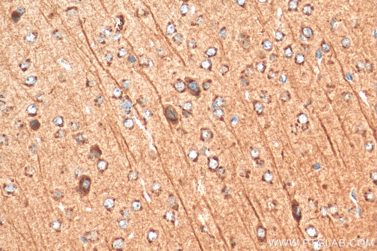 Immunohistochemistry (IHC) staining of mouse brain tissue using MOG Polyclonal antibody (12690-1-AP)