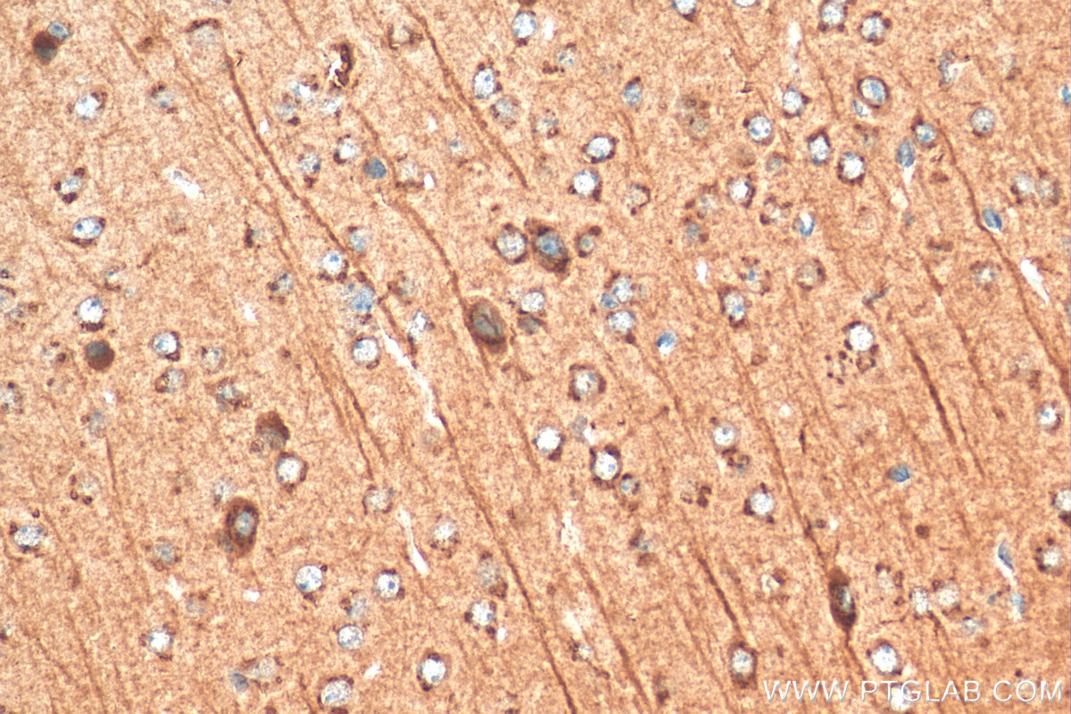 IHC staining of mouse brain using 12690-1-AP