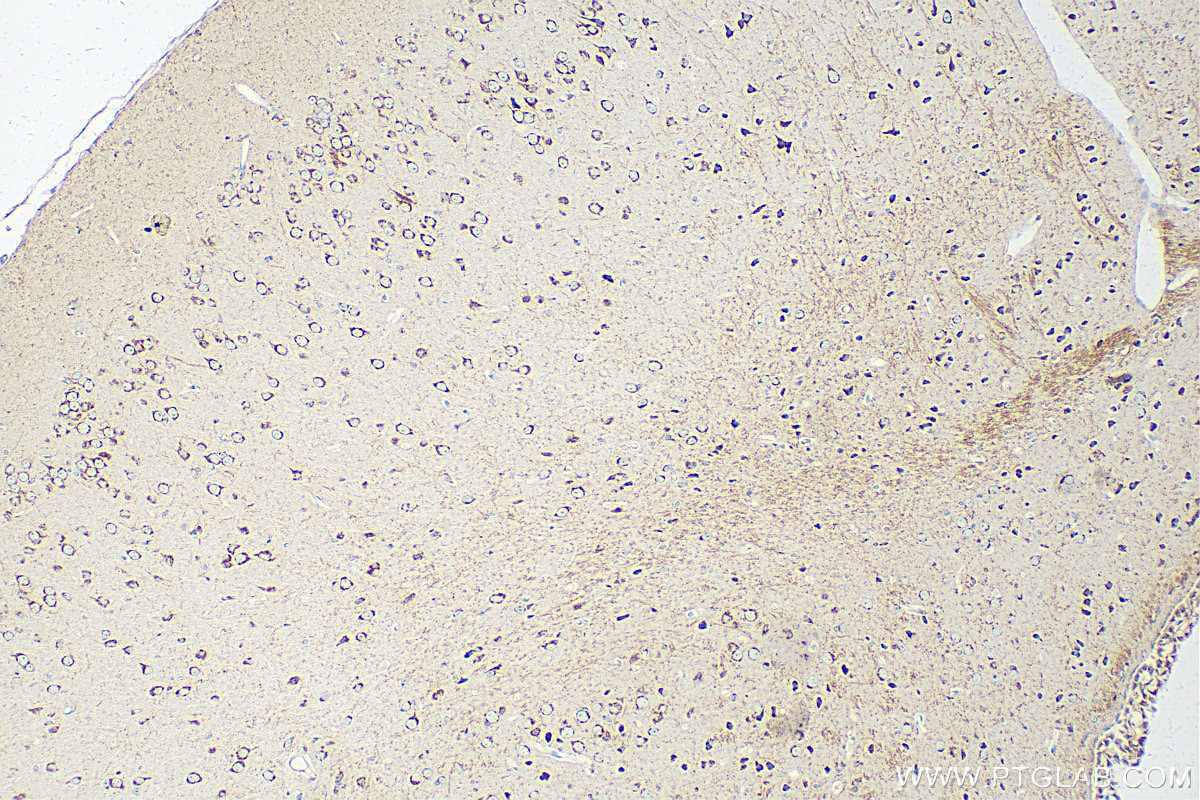 Immunohistochemistry (IHC) staining of mouse brain tissue using MOG Polyclonal antibody (12690-1-AP)