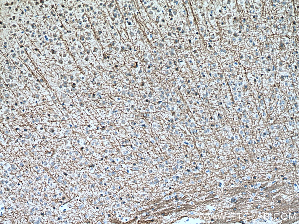 Immunohistochemistry (IHC) staining of mouse brain tissue using MOG Polyclonal antibody (28752-1-AP)