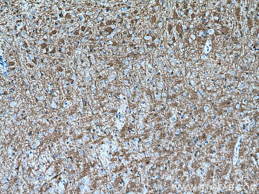 Immunohistochemistry (IHC) staining of rat brain tissue using MOG Polyclonal antibody (28752-1-AP)