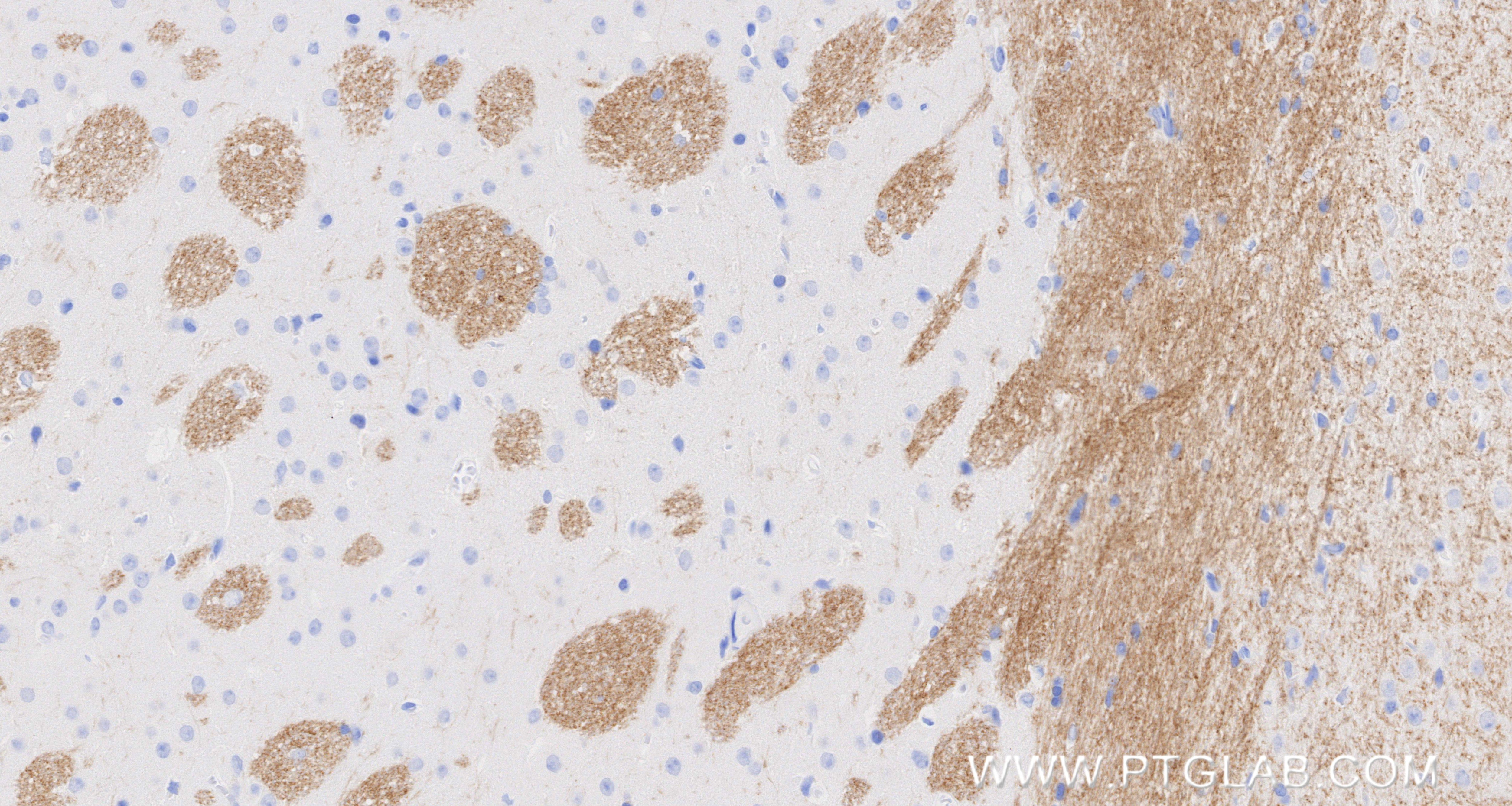 Immunohistochemistry (IHC) staining of mouse brain tissue using MOG Recombinant monoclonal antibody (83063-6-RR)