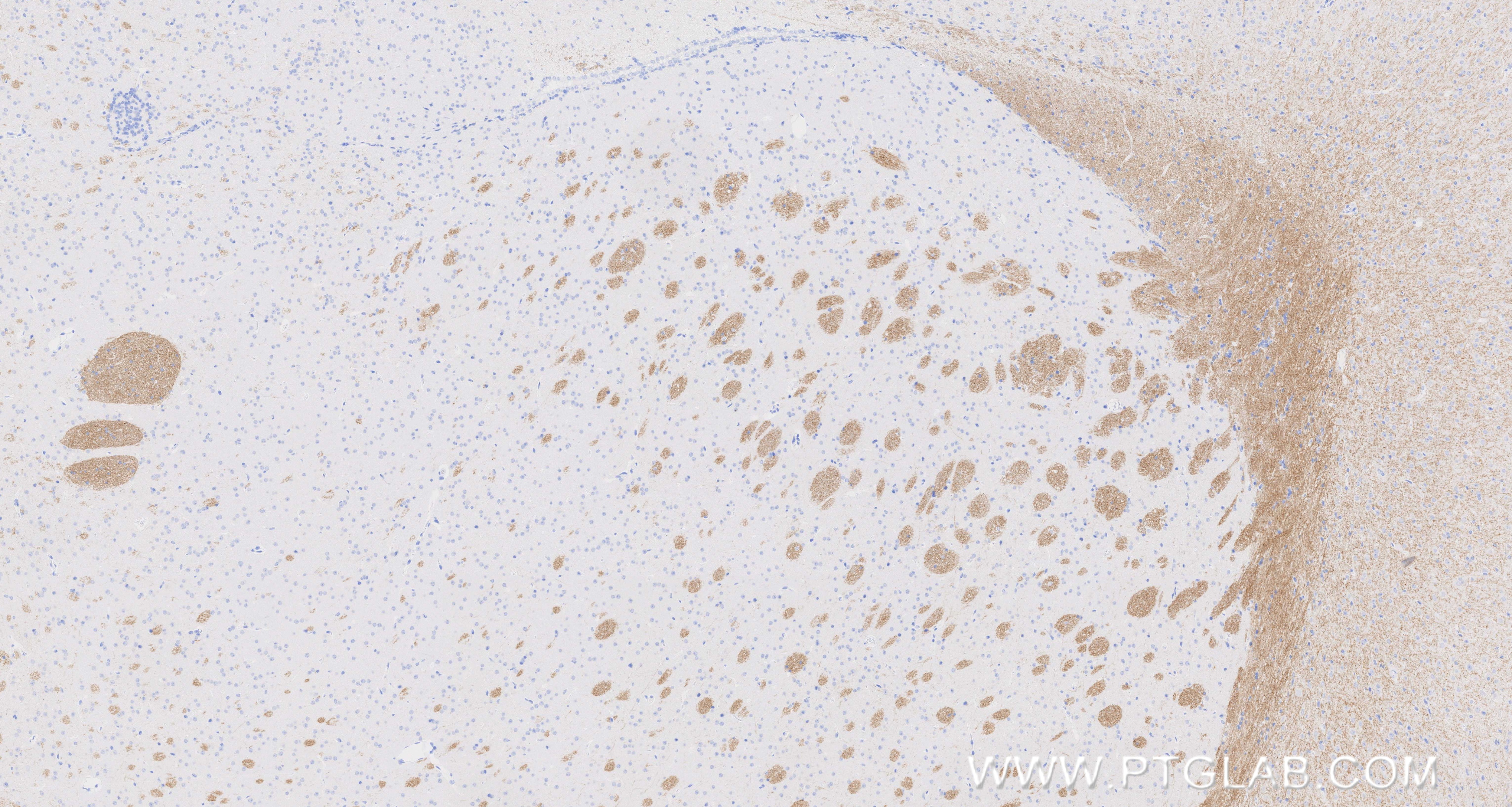 Immunohistochemistry (IHC) staining of mouse brain tissue using MOG Recombinant monoclonal antibody (83063-6-RR)
