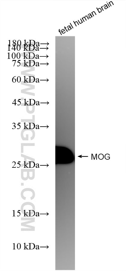 Western Blot (WB) analysis of fetal human brain tissue using MOG Recombinant monoclonal antibody (83063-6-RR)