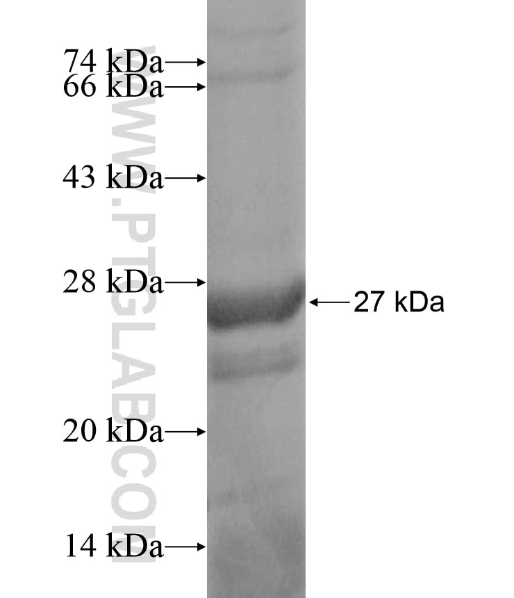 MOGAT1 fusion protein Ag17071 SDS-PAGE