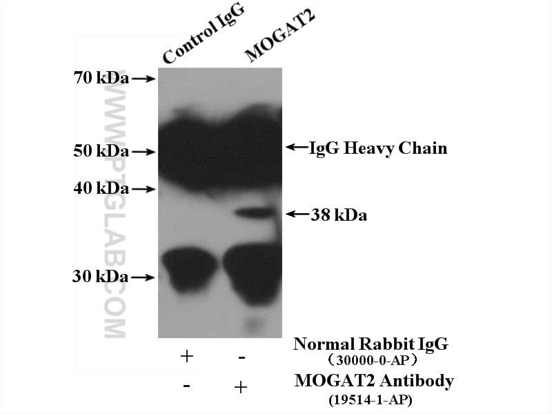 Immunoprecipitation (IP) experiment of HEK-293 cells using MOGAT2 Polyclonal antibody (19514-1-AP)