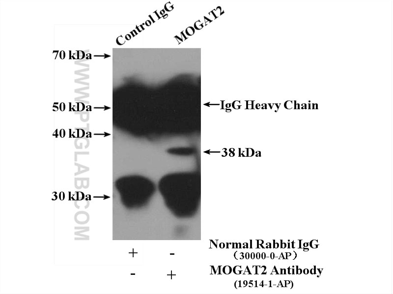 IP experiment of HEK-293 using 19514-1-AP