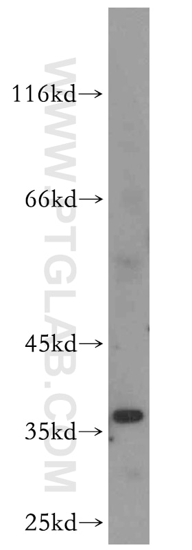 Western Blot (WB) analysis of HEK-293 cells using MOGAT2 Polyclonal antibody (19514-1-AP)