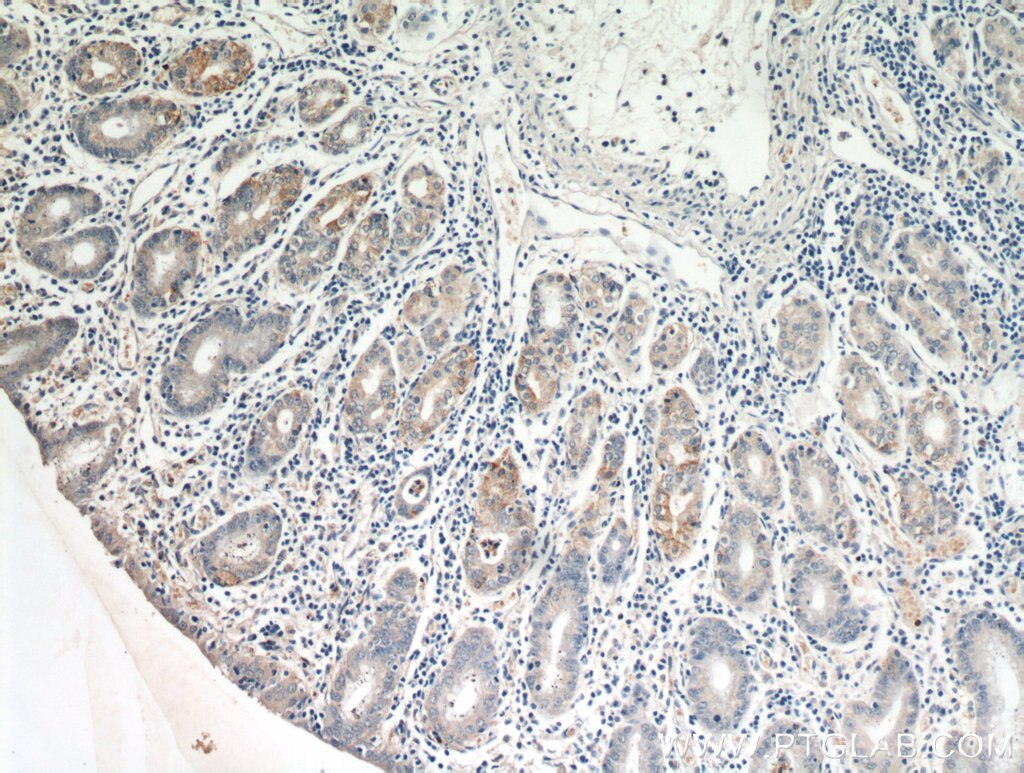 Immunohistochemistry (IHC) staining of human stomach tissue using MOGAT2 Polyclonal antibody (21286-1-AP)