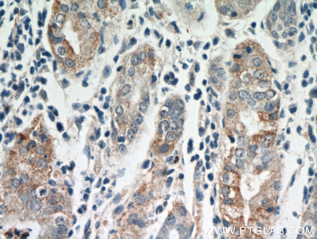 Immunohistochemistry (IHC) staining of human stomach tissue using MOGAT2 Polyclonal antibody (21286-1-AP)