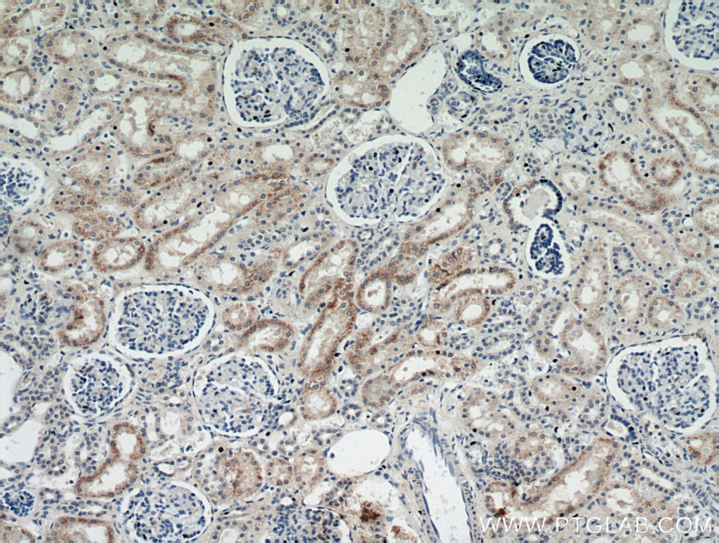 Immunohistochemistry (IHC) staining of human kidney tissue using MOGAT2 Polyclonal antibody (21286-1-AP)