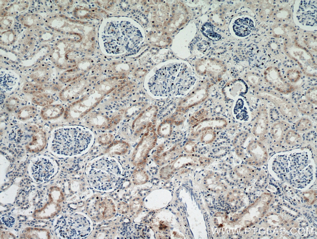 IHC staining of human kidney using 21286-1-AP