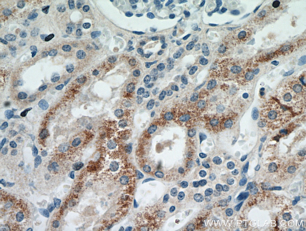 Immunohistochemistry (IHC) staining of human kidney tissue using MOGAT2 Polyclonal antibody (21286-1-AP)