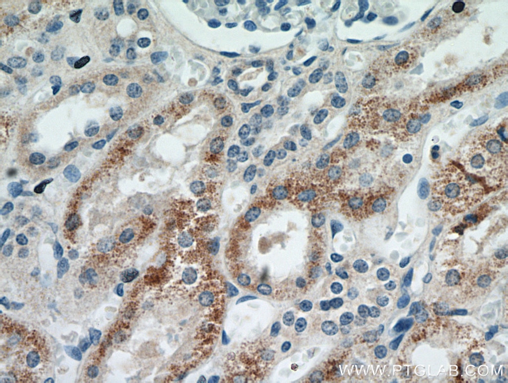 IHC staining of human kidney using 21286-1-AP