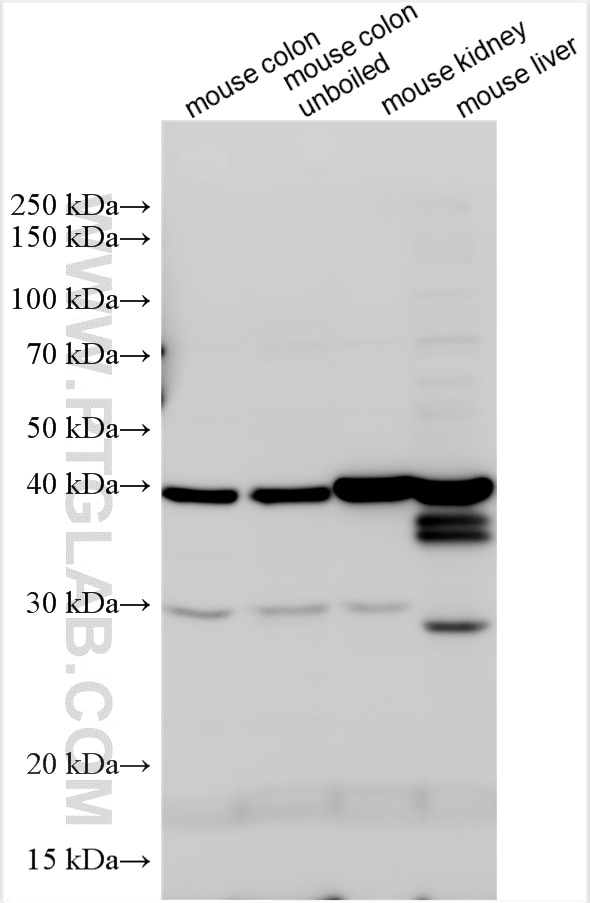 Western Blot (WB) analysis of various lysates using MOGAT2 Polyclonal antibody (21286-1-AP)