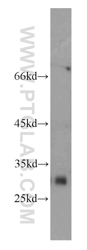 Western Blot (WB) analysis of HL-60 cells using MOGAT2 Polyclonal antibody (21286-1-AP)