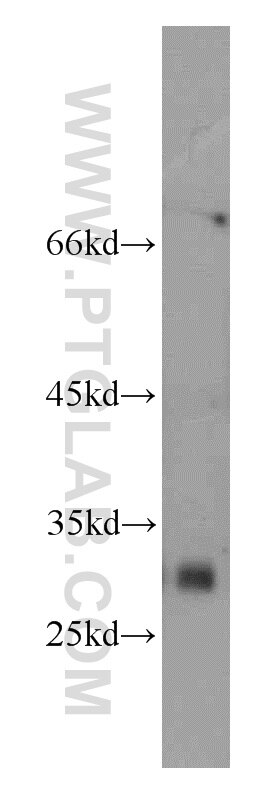 Western Blot (WB) analysis of HL-60 cells using MOGAT2 Polyclonal antibody (21286-1-AP)