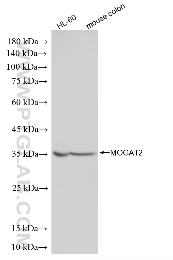 Western Blot (WB) analysis of various lysates using MOGAT2 Recombinant monoclonal antibody (83086-3-RR)