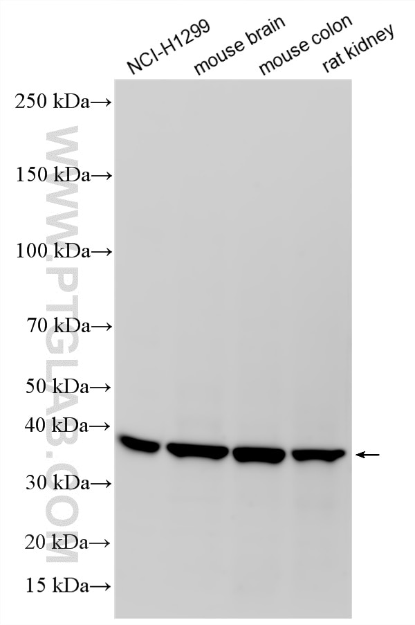 Western Blot (WB) analysis of various lysates using MOGAT2 Recombinant monoclonal antibody (83086-3-RR)