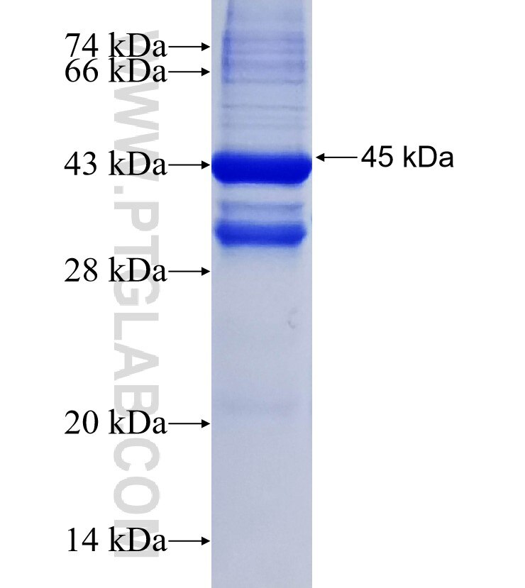 MOGAT2 fusion protein Ag15806 SDS-PAGE