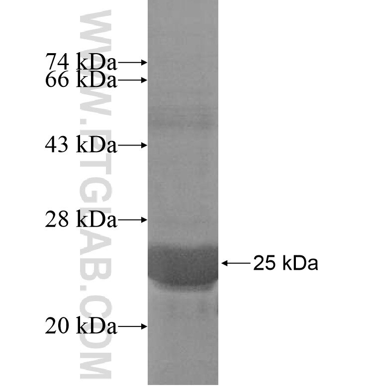 MOGAT2 fusion protein Ag16923 SDS-PAGE