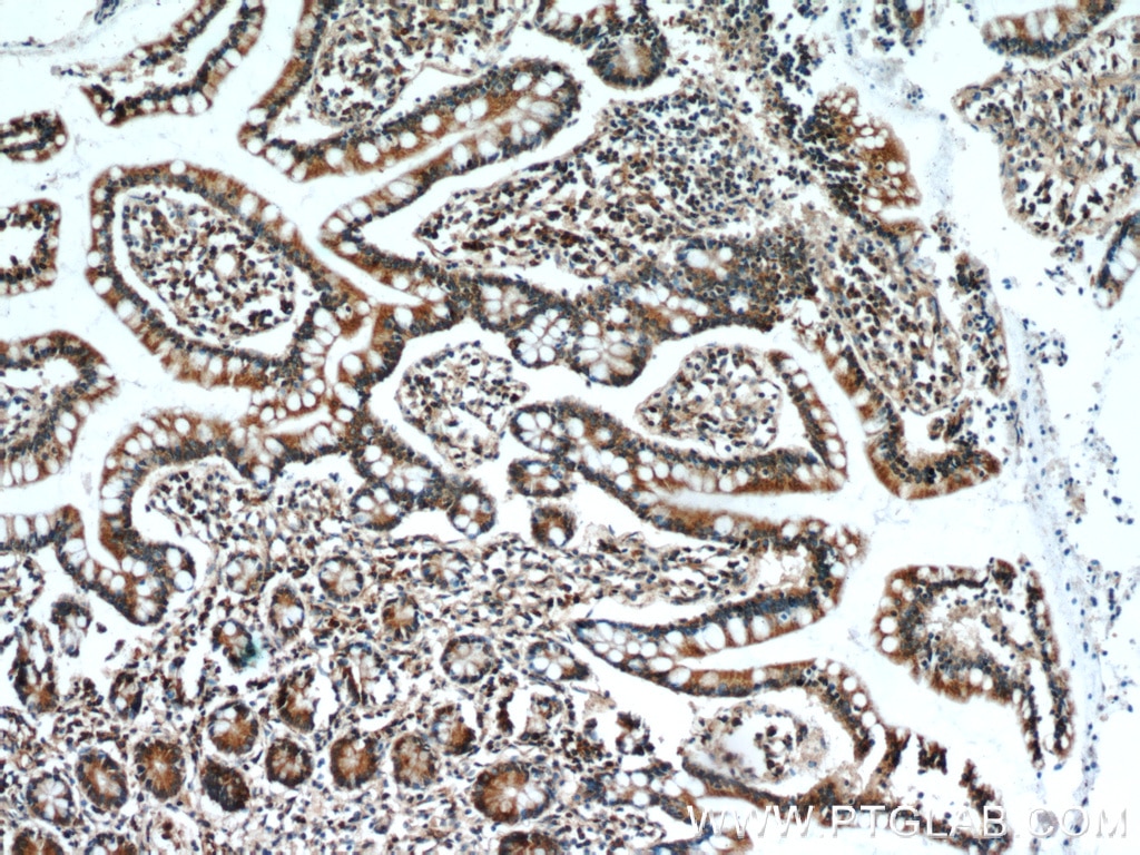 Immunohistochemistry (IHC) staining of human small intestine tissue using GCS1 Polyclonal antibody (17859-1-AP)