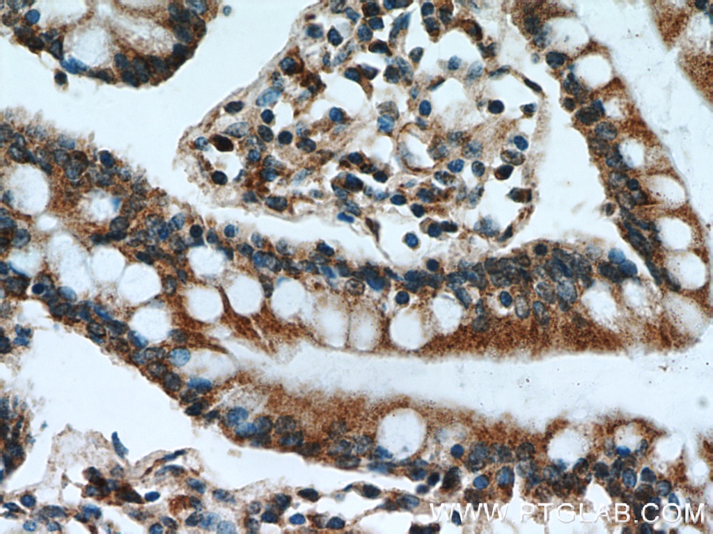 Immunohistochemistry (IHC) staining of human small intestine tissue using GCS1 Polyclonal antibody (17859-1-AP)