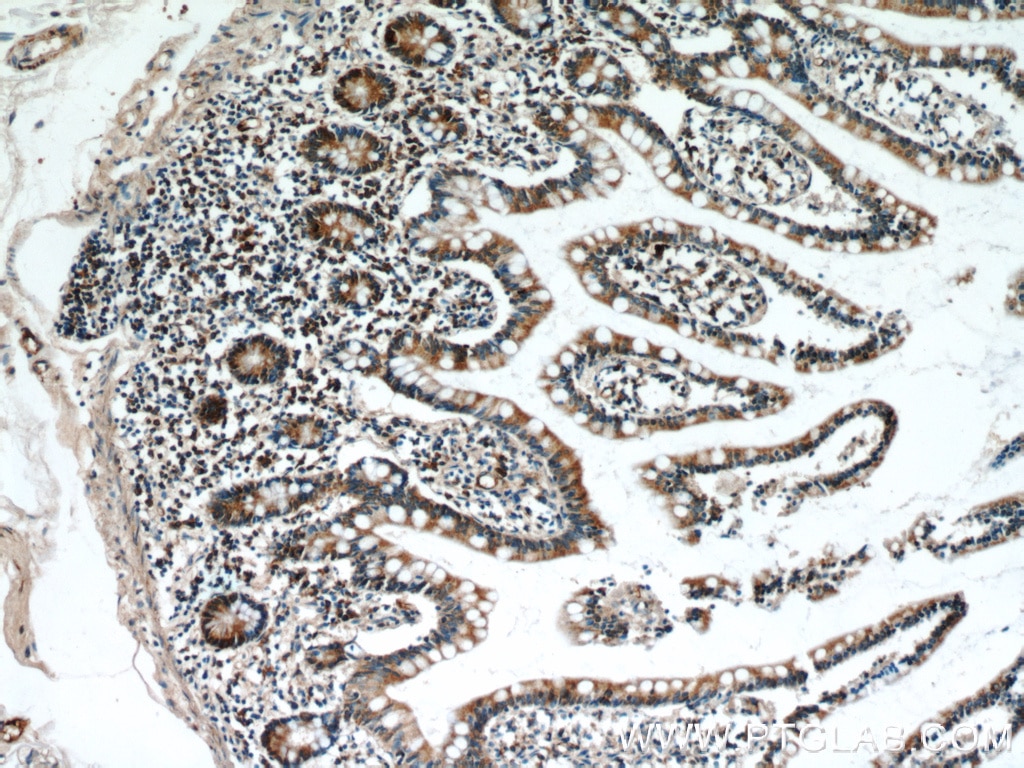 Immunohistochemistry (IHC) staining of human small intestine tissue using GCS1 Polyclonal antibody (17859-1-AP)