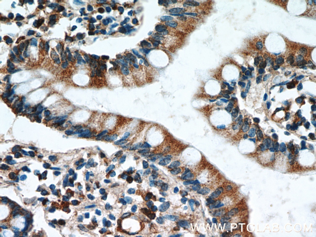 Immunohistochemistry (IHC) staining of human small intestine tissue using GCS1 Polyclonal antibody (17859-1-AP)