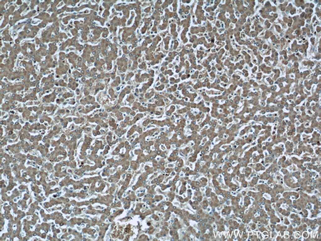 Immunohistochemistry (IHC) staining of human liver tissue using GCS1 Polyclonal antibody (17859-1-AP)