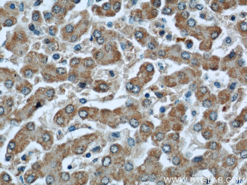Immunohistochemistry (IHC) staining of human liver tissue using GCS1 Polyclonal antibody (17859-1-AP)