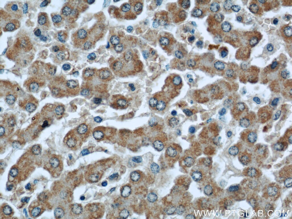 Immunohistochemistry (IHC) staining of human liver tissue using GCS1 Polyclonal antibody (17859-1-AP)