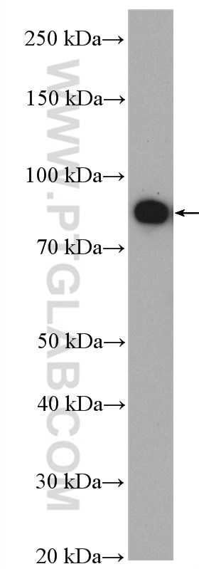 Western Blot (WB) analysis of COLO 320 cells using GCS1 Polyclonal antibody (17859-1-AP)