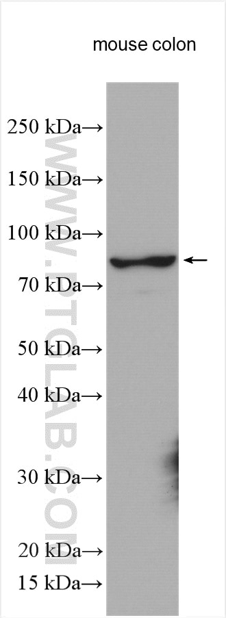 Western Blot (WB) analysis of various lysates using GCS1 Polyclonal antibody (17859-1-AP)