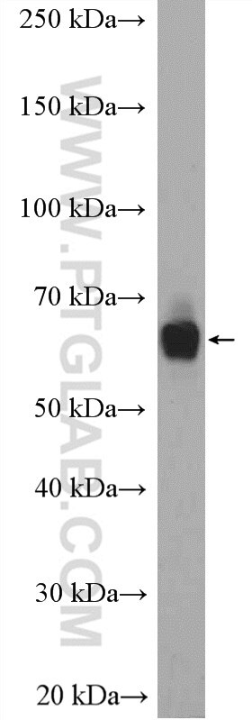Western Blot (WB) analysis of Jurkat cells using MON1A Polyclonal antibody (23772-1-AP)